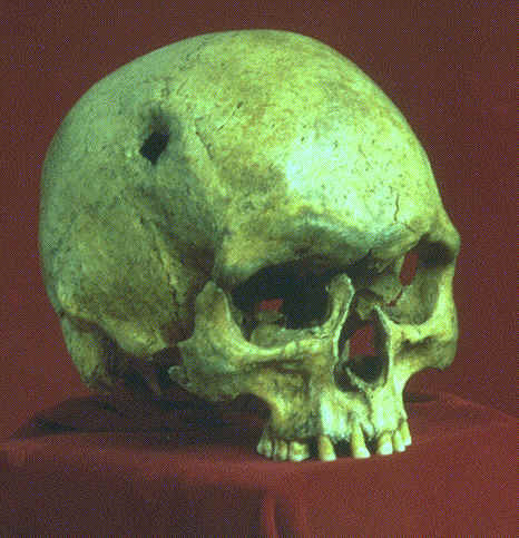 Der Schädel von Zillingtal